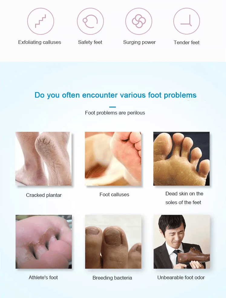 Elektrisk pedicure fod fil - Genopladelig via